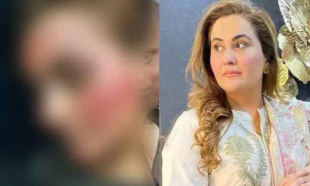 Actress Nargis assaulted by husband over money dispute